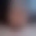 Chat med  acifias86289